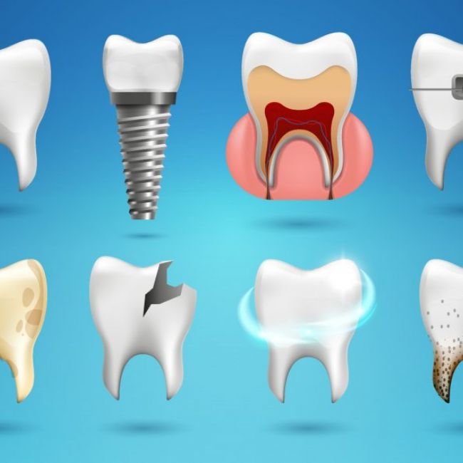 periodoncia
