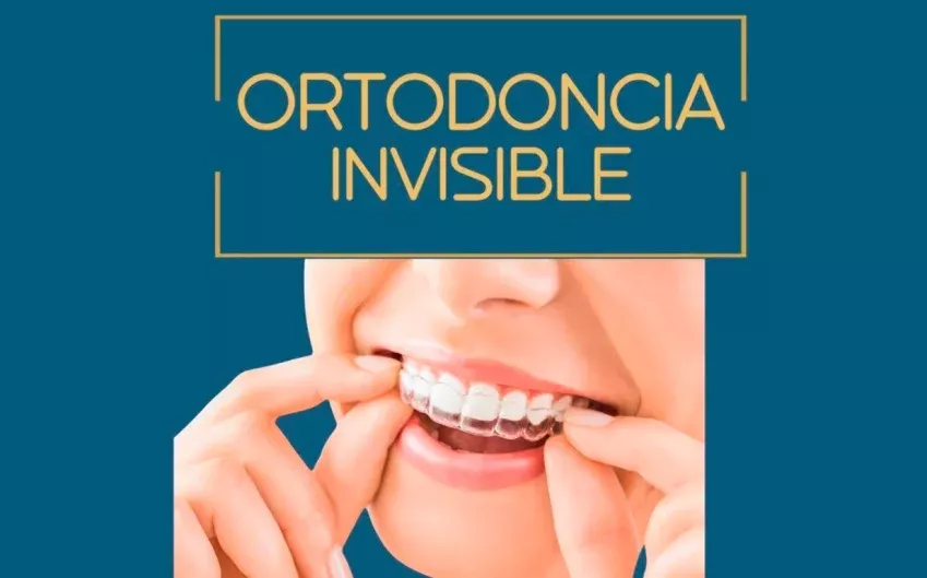 Ortodoncia invisible en Alcobendas en la Clínica Dental Lacaci, una opción discreta y eficaz para alinear los dientes.