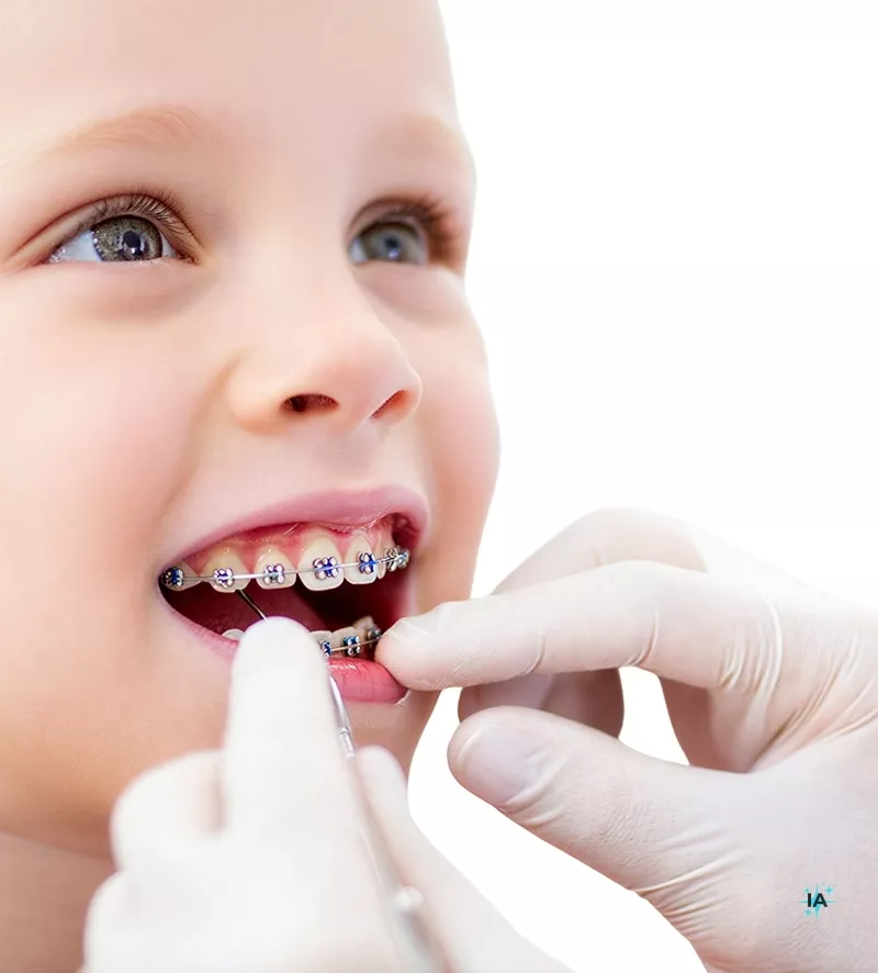 Servicios de salud y estética dental en la Clínica Dental Lacaci, ubicada en Alcobendas, para mejorar tu sonrisa.