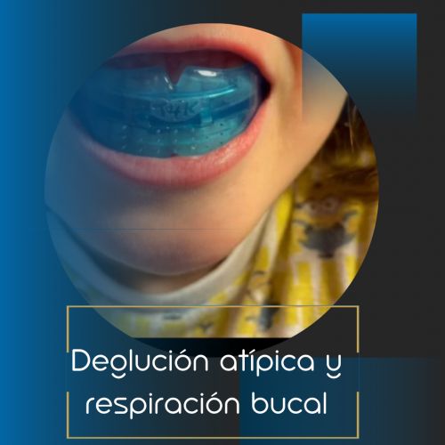 Deglución atípica y respiracion bucal