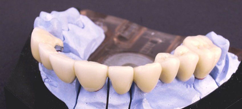 injertos en Alcobendas