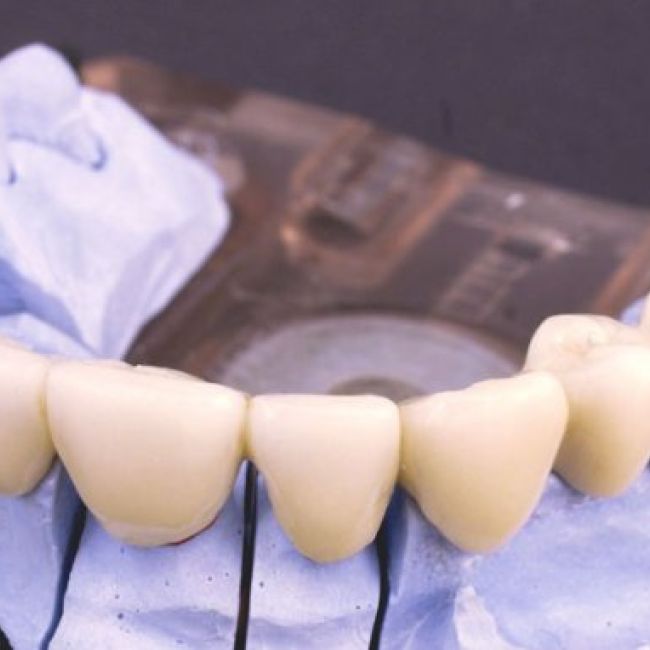 injertos en Alcobendas