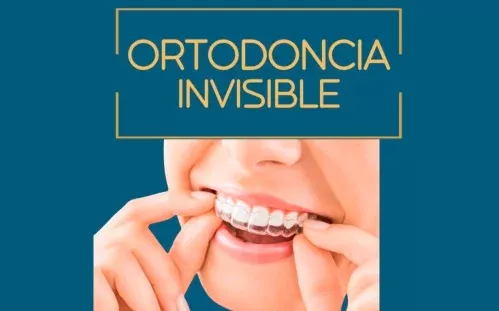 Ortodoncia invisible en Alcobendas en la Clínica Dental Lacaci, una opción discreta y eficaz para alinear los dientes.