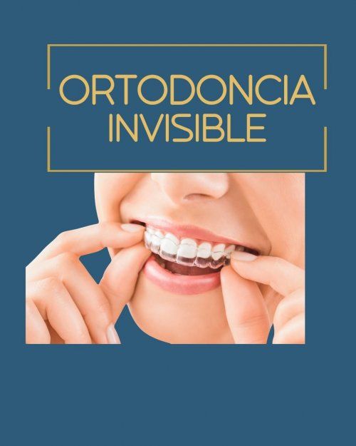 ORTODONCIA INVISIBLE INVISALIGN